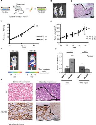 Extracellular vesicles secreted from bone metastatic renal cell carcinoma promote angiogenesis and endothelial gap formation in bone marrow in a time-dependent manner in a preclinical mouse model